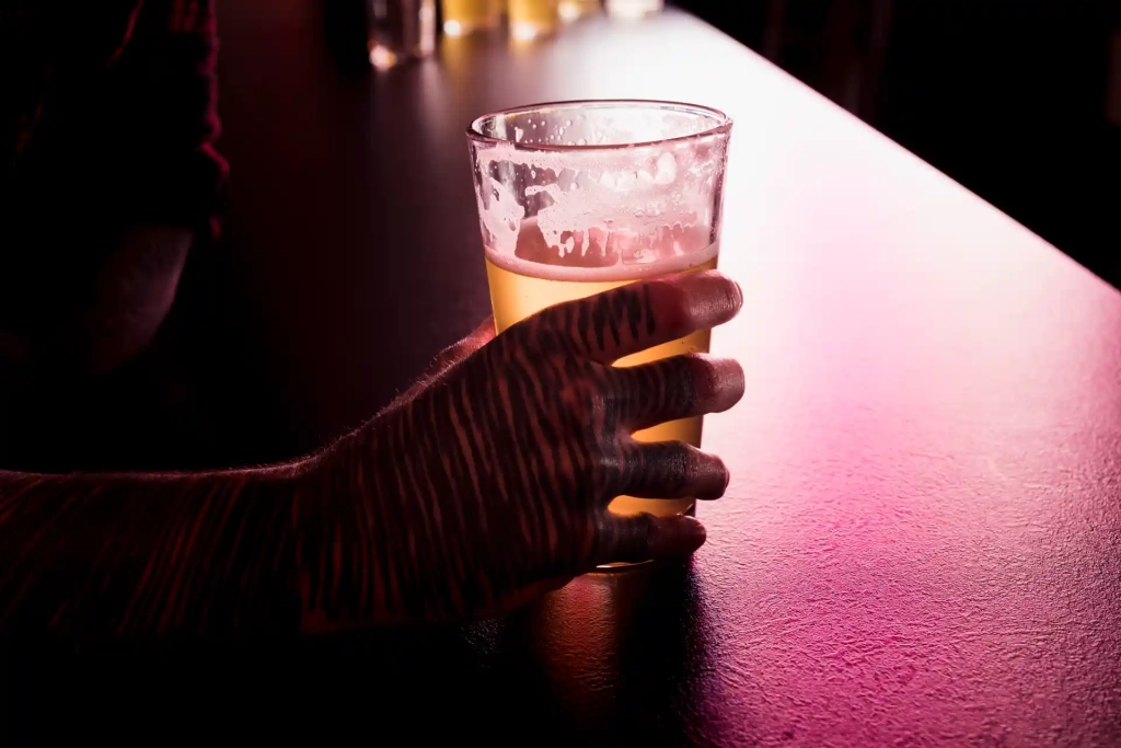 FAQ – Intoxicação por Metanol 1. O que é intoxicação por metanol? É um envenenamento causado pelo consumo de bebidas adulteradas com metanol, um álcool tóxico que pode levar à cegueira e à morte. 2. Quais os sintomas iniciais da intoxicação? Náusea, dor de cabeça, dor abdominal, tontura e vômitos. 3. A intoxicação por metanol pode causar cegueira? Sim, o nervo óptico é altamente sensível ao metanol, e o dano pode ser irreversível. 4. Como é feito o tratamento? Com antídotos como fomepizol ou etanol hospitalar, além de hemodiálise nos casos graves. 5. Como evitar o risco? Nunca consuma bebidas sem procedência. Prefira marcas confiáveis e locais autorizados de venda.